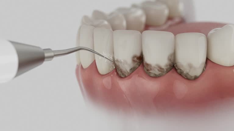 Trusted Wisdom Tooth Removal service in Villa Ridge, MO - Dentist Open Now